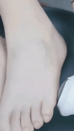 REMOVEDOR DE CALLOS : SUAVIDAD Y CONFORT